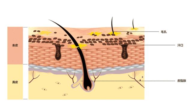 皲裂红脸蛋,宝宝皮肤皲裂擦面霜泛红