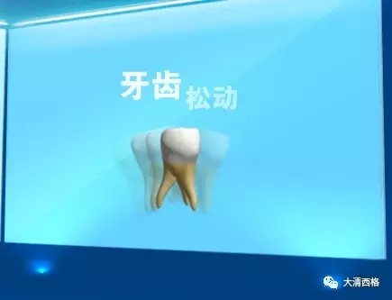 牙齿全部松动还能固定不松动吗,牙齿松动用舌头顶松动