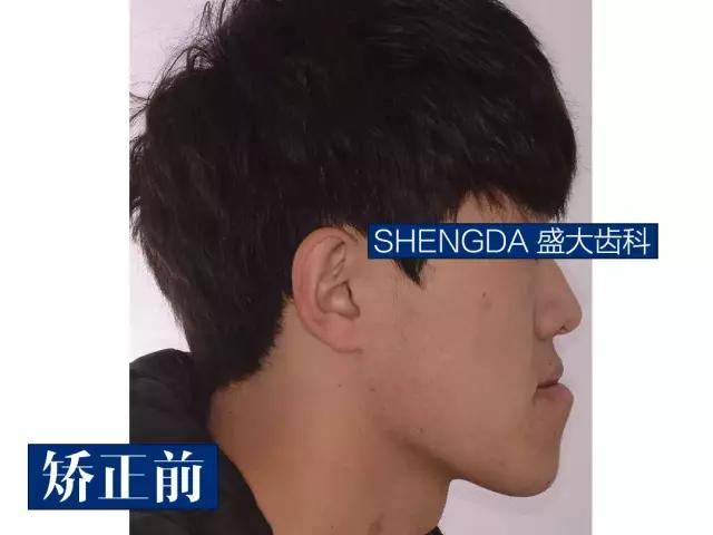 山西“爱马仕”级别齿科医院！get明星同款笑容