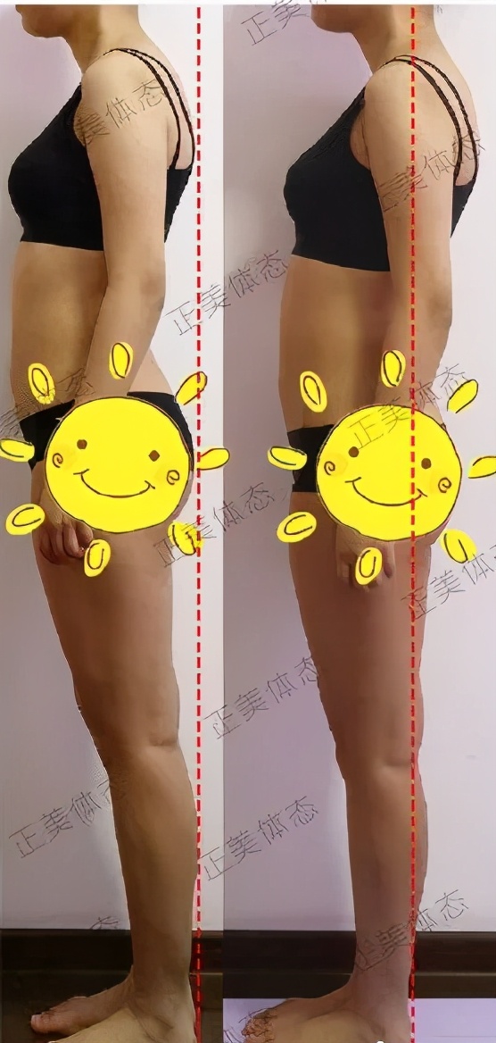 顽固体质的大粗腿怎么瘦下来,顽固腿粗怎么都减不下来咋办