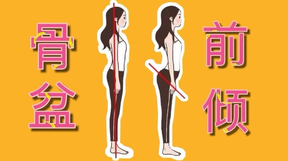 两腿并拢大腿有缝隙怎么练改善,双腿并拢时大腿处有缝隙怎么办