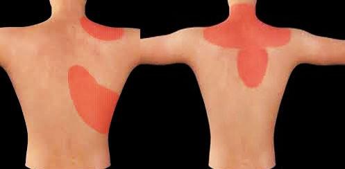 肩膀疼痛竟是如此大问题不可小觑,肩膀疼痛的辨别和解决方法