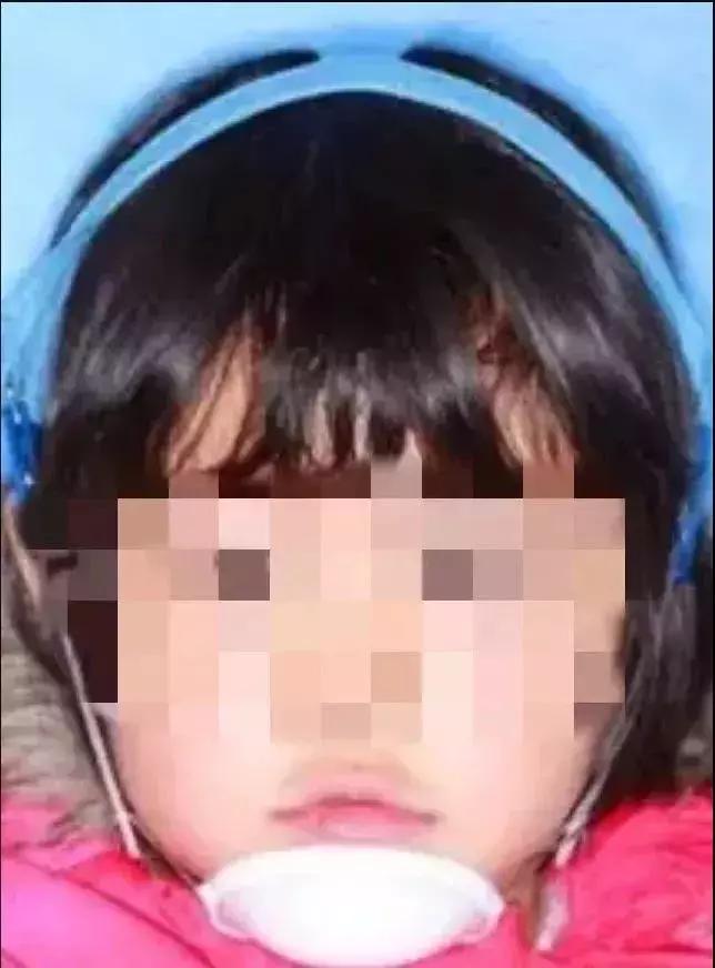 地包天早期矫正最佳时间,地包天10-15岁矫正是最佳年龄吗