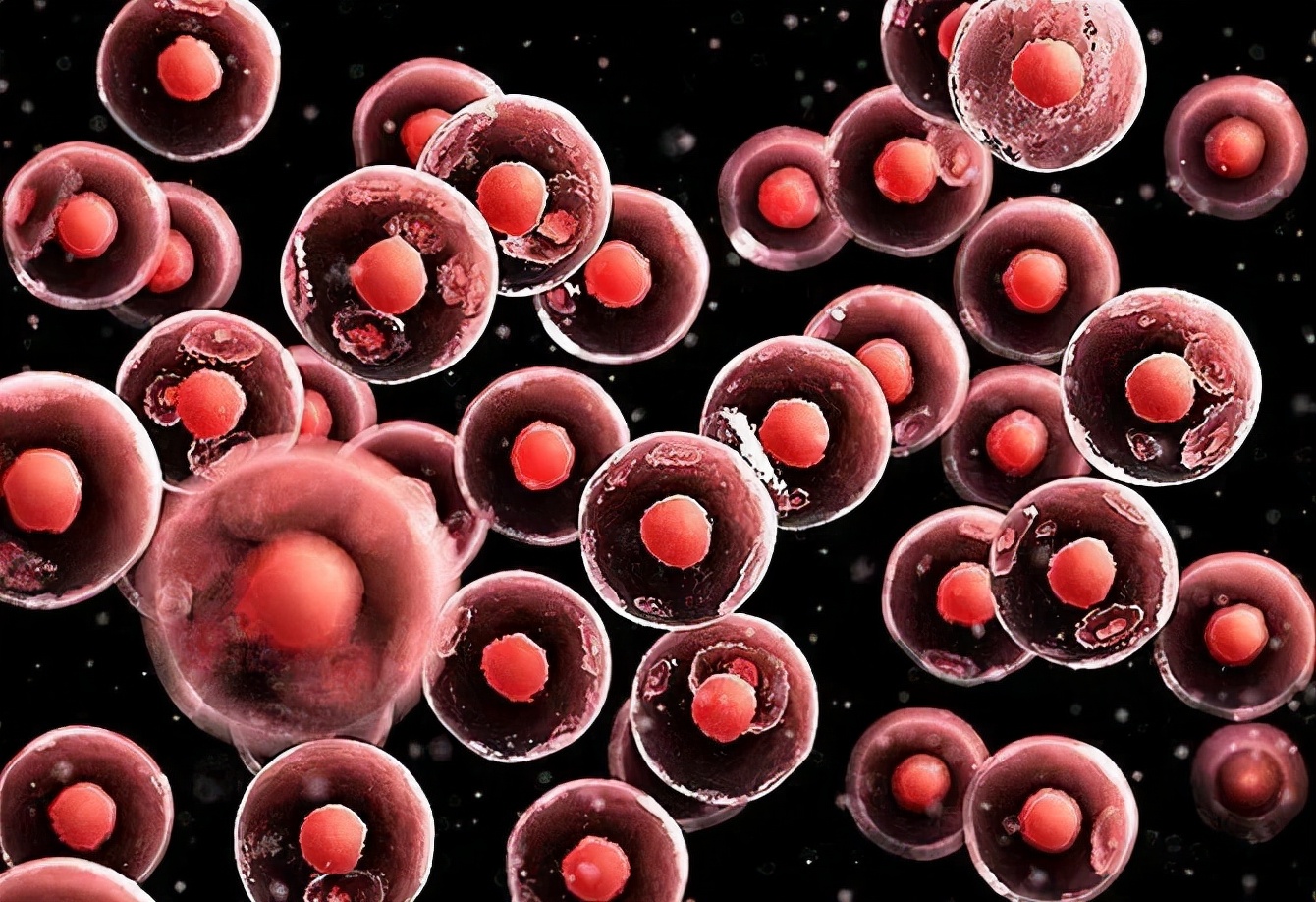 什么是淋巴瘤淋巴瘤有哪些症状,淋巴瘤的特征及治疗方法