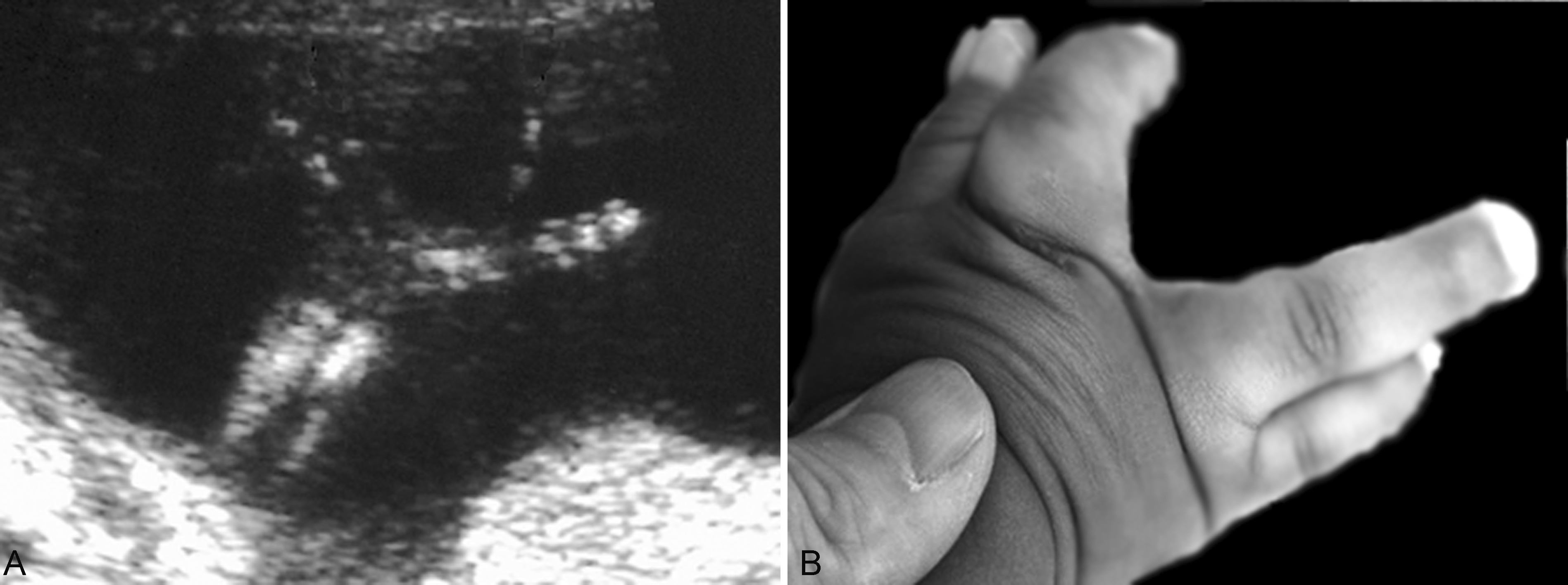 明明白白做ct检查,明明白白做超声