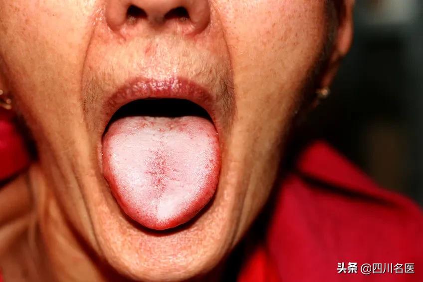 端午节当天晒太阳祛除寒湿,端午节前后是湿气比较旺盛的时候