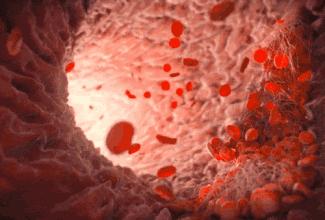 关节置换术后伤口肿胀原因,全髋关节置换五个月了怎么刀口痛