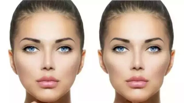 牙齿矫正造成牙隐裂,矫正牙齿后感觉牙齿变龅了