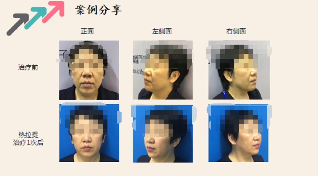 送给爱美的你！5.25护肤日，苏州科技城医院皮肤美容优惠享不停