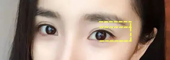 最漂亮的双眼皮形态,双眼皮形态分类