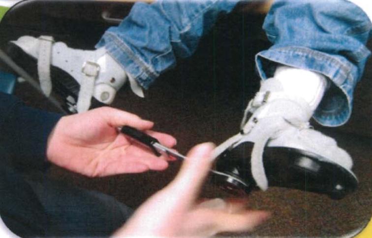 马蹄内翻足支具需要穿多久,马蹄内翻足穿鞋了怎么按摩