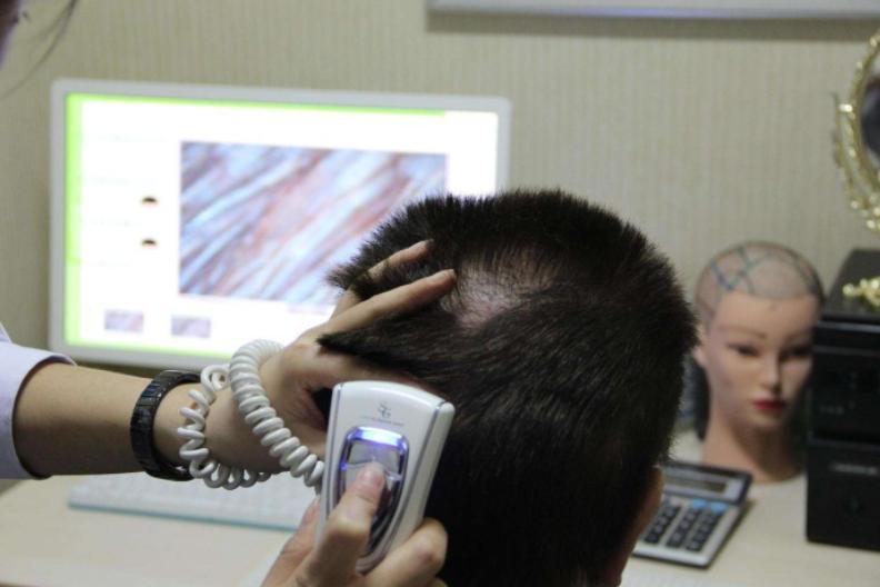 头发发质太差怎么办,发质不好妙招教你养出好头发