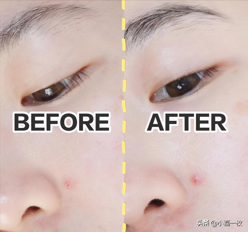 熬夜脸色蜡黄用什么精华,熬夜蜡黄脸怎么改善