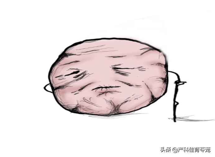 月经量少，一定是卵巢功能衰退吗？