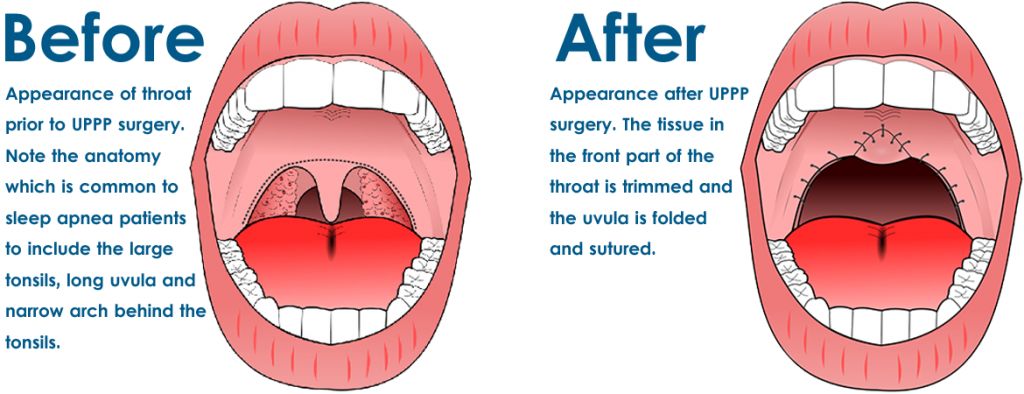 世界睡眠日科普视频,世界睡眠日科普类短视频