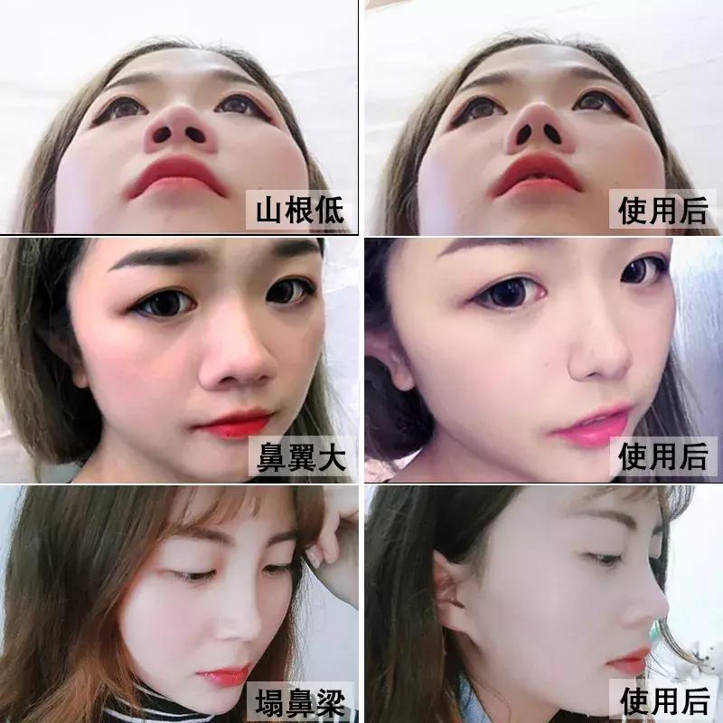 破误区碎谣言揭开精油的真实面纱,隆鼻精油真的有效吗