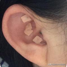 中医月经不调学习把脉方法,昆明看月经不调最好的中医