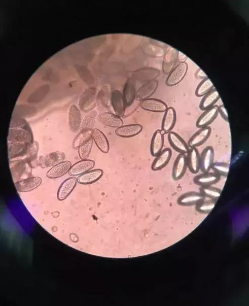 4岁小女孩屁屁痒,妈妈脱下裤子检查后吓坏了:一粒粒竟还会动