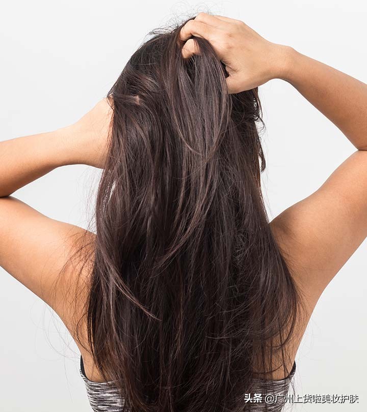 头皮经常发痒怎么办,头皮总是痒是什么原因怎么缓解