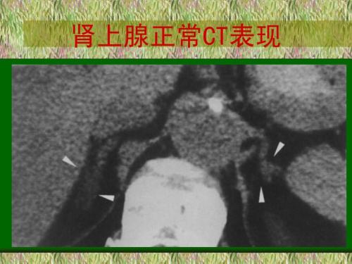 爱美女子如何能忍受自己多毛呢？“多毛症”的前世今生，请看此文