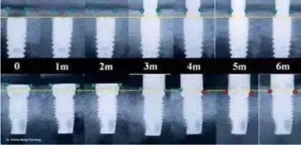 如何自己处理残根,怎样的残根可保留
