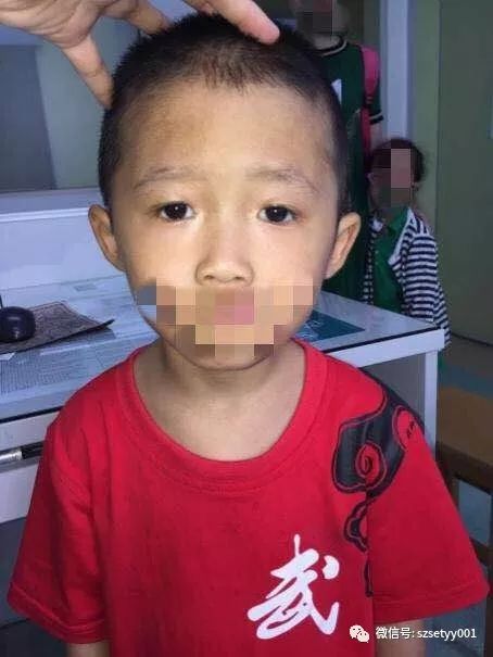 4-6岁儿童自测视力结果,6岁小孩测视力1.0需要看清几个