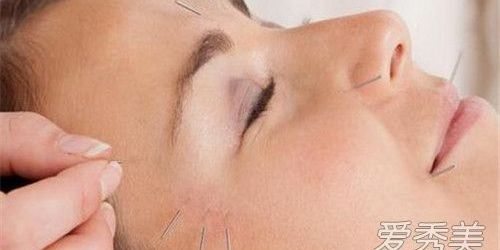 针灸瘦脸视频教程,针灸瘦脸有什么副作用