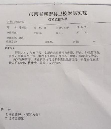 肾囊肿割掉又复发是什么原因,肾囊肿恶性切掉了