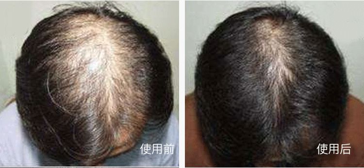 外用中药眼膜,中药眼膜去眼袋眼纹