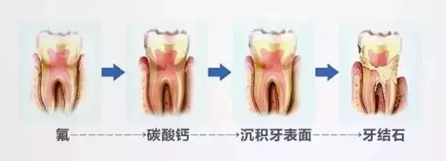 新西兰哪种牙膏最好用,去牙齿黄渍最好的牙膏测评