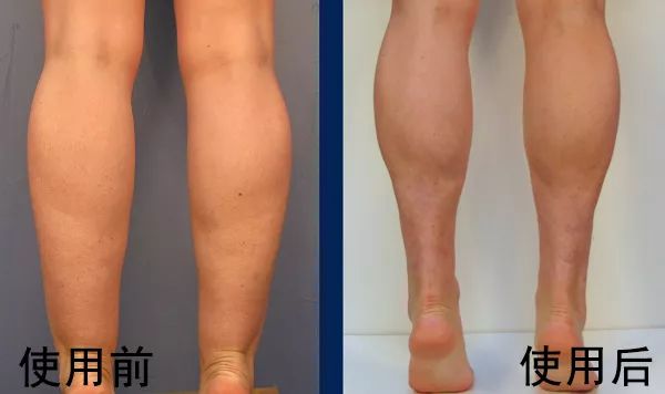 排油减脂抗糖解油腻,吸油刮油减肥法