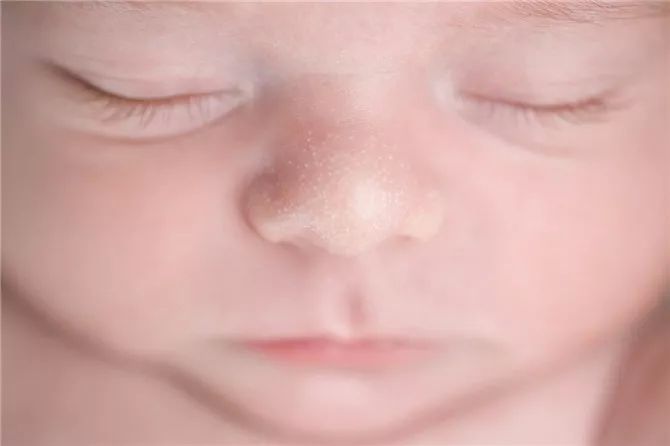 宝宝这10个吓坏新手妈妈的问题，其实每个都正常！