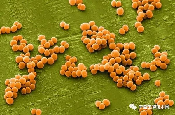 什么抗生素对金黄色葡萄球菌有效,金黄色葡萄球菌最怕什么益生菌