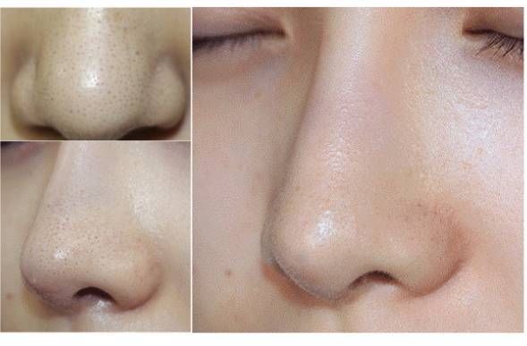 喷一喷,黑头油脂自动溶解!日本爆款清洁喷雾还你一个嫩*b嫩**aby肌!