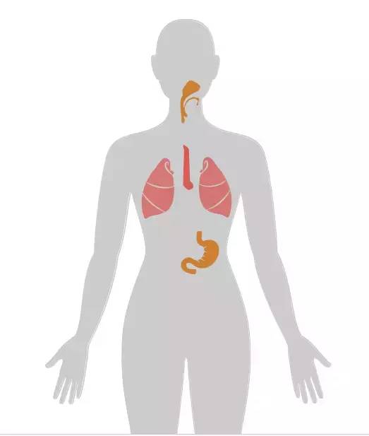 18张癌症人体地图，揭秘致癌真相！