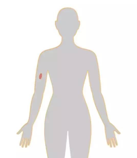 18张癌症人体地图，揭秘致癌真相！