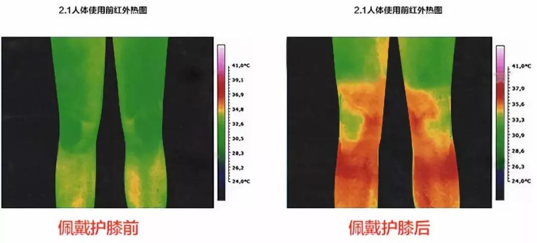 护膝电热保暖老寒腿,适合老寒腿的护膝