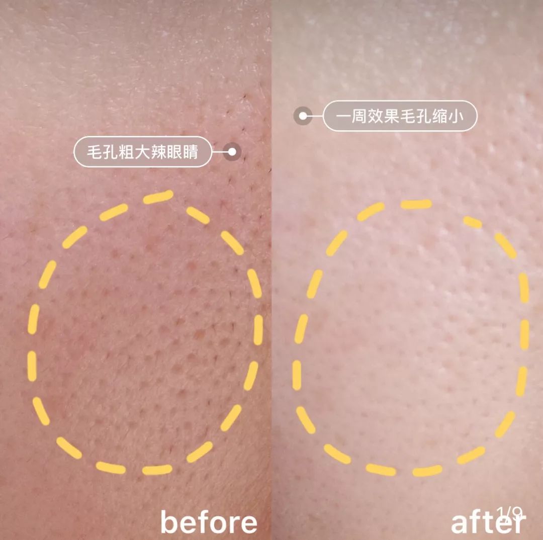 安瓶补水紧致提拉去皱精华,嫩白抗皱安瓶精华