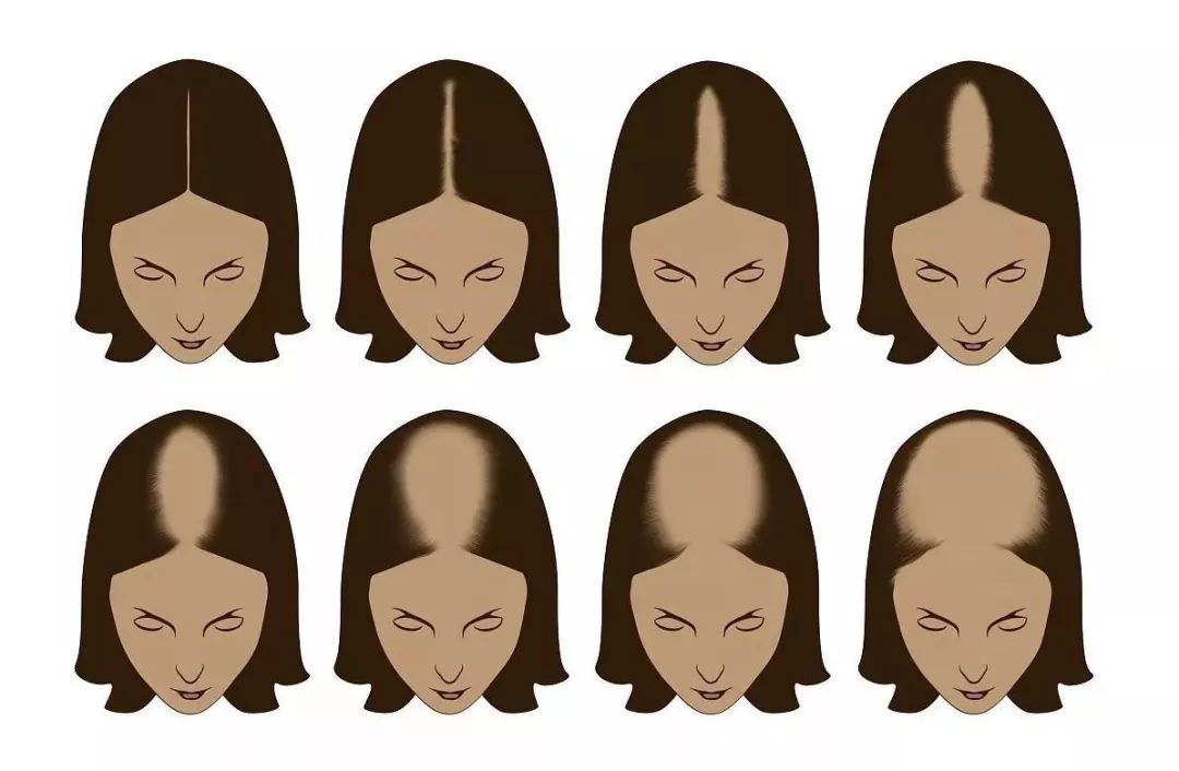 吴彦祖追忆迷局发型,吴彦祖年轻时的发型