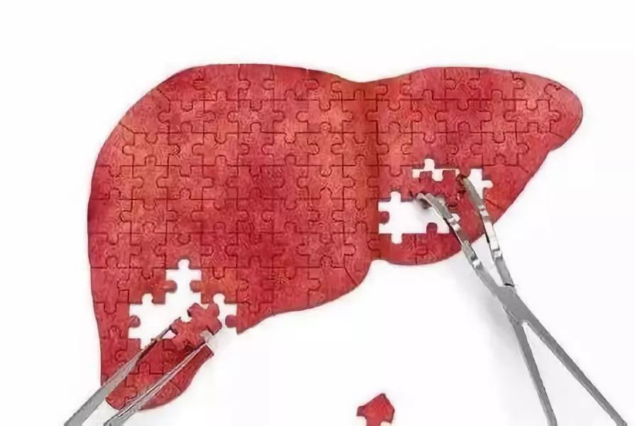 转氨酶升高中药怎样治疗,转氨酶升高中医治疗