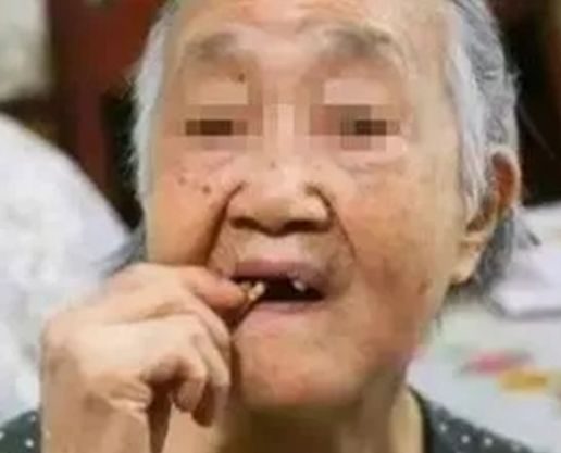 哪十家医院种植牙享受补贴,缺牙市民可申请免费种牙