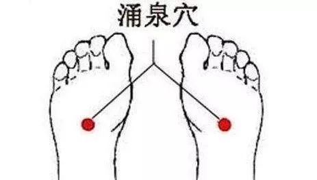 脚后跟鱼鳞状干裂用什么药,脚后跟干裂小腿长鱼鳞