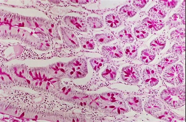 粘液和粘蛋白：它们在抑制HIV病毒时起作用吗？