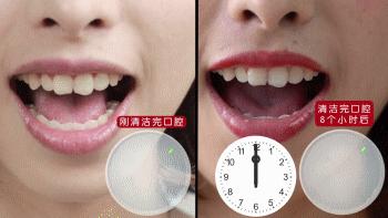 闭着嘴巴一直有口水,闭着嘴巴往外呼气的时候有臭味