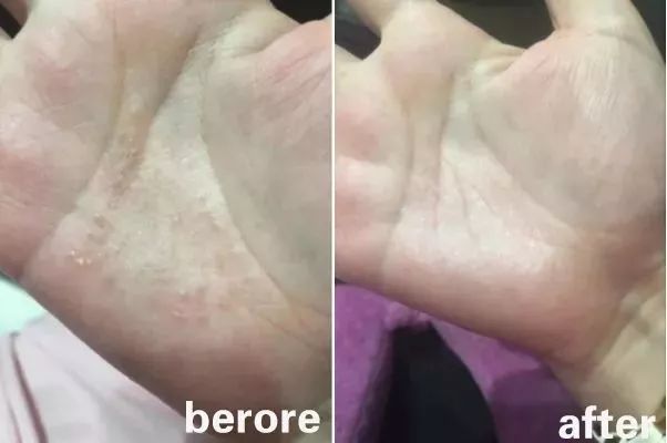 清凉止痒防暑醒神膏,止痒的草药膏