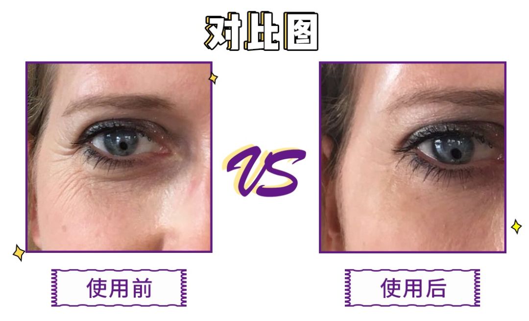 一分钟提拉紧致去除眼袋皱纹,修眼袋祛皱纹神器