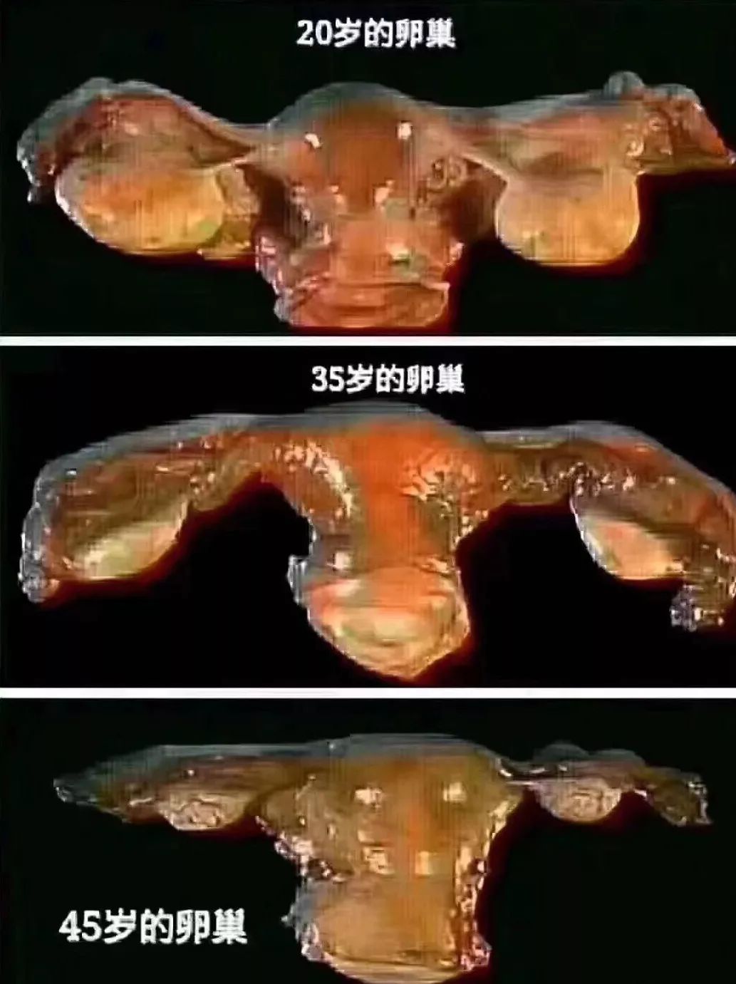 异地恋遇到姐弟恋,怎么维持异地恋和姐弟恋