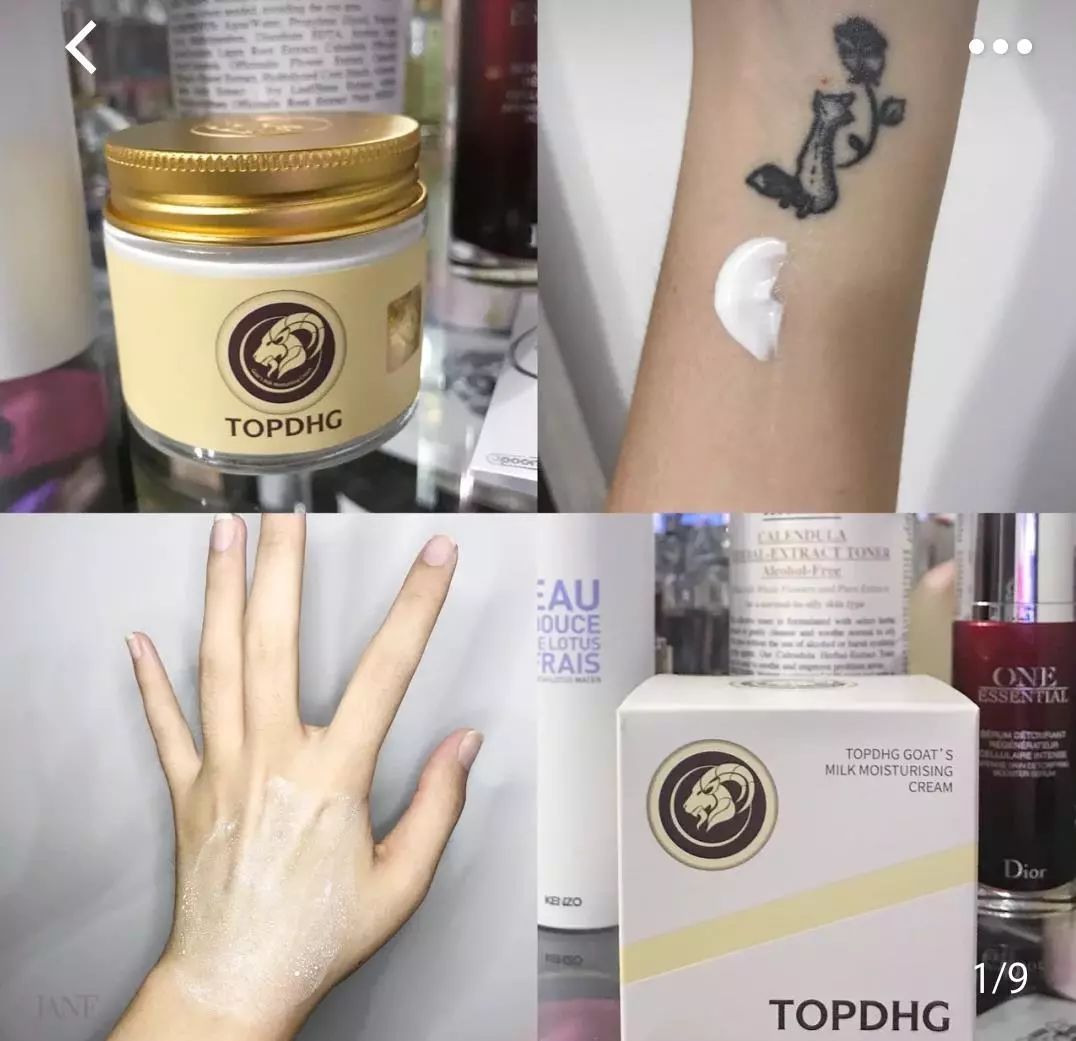 脱发算啥!90后已经开始长“老年斑”了,有人还为此花了10多万!