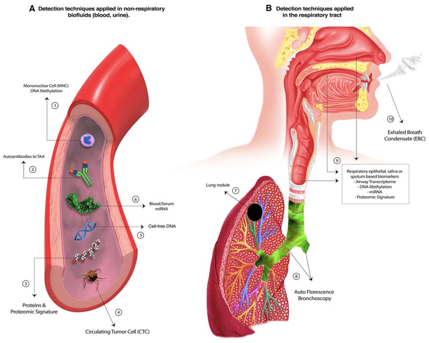 低剂量螺旋ct肺癌筛查专家共识,低剂量ct肺癌筛查有意义吗