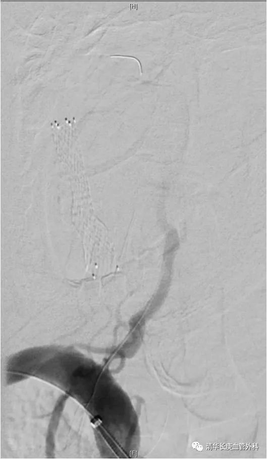 教学相长共同成长,北京清华长庚医院周围血管外科